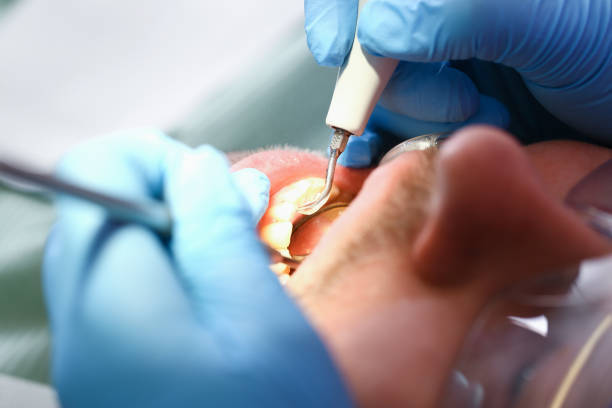 Best Emergency Gum Treatment in Castle Dale, UT
