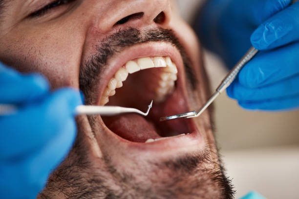 Best Emergency Treatment for Dental Infections or Abscesses in Castle Dale, UT